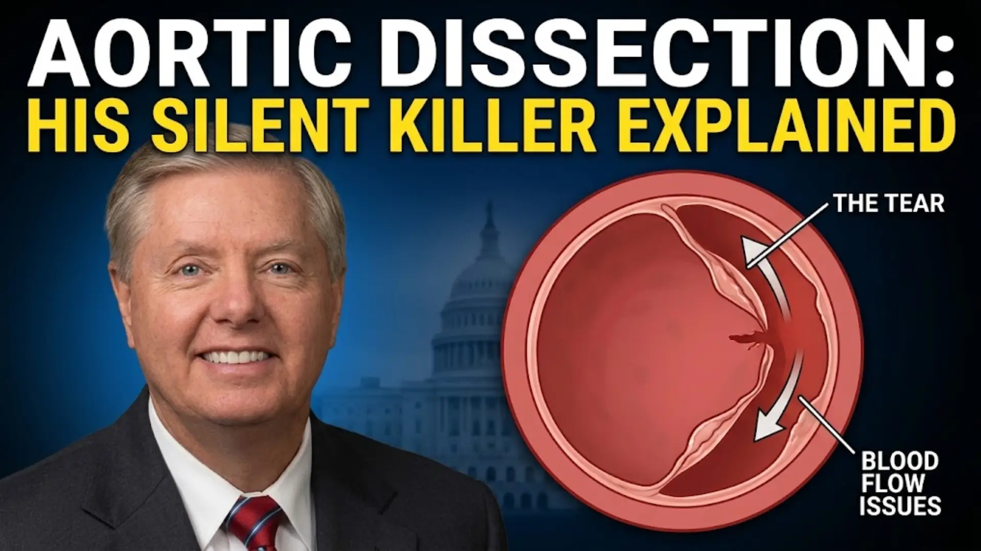 Lindsey Graham's Cause of Death: What Doctors Say About His Aortic Dissection